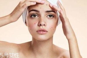 痘痘反復(fù)長(zhǎng)是什么原因？基礎(chǔ)護(hù)膚不夠用心