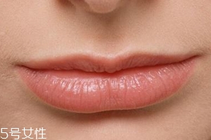 嘴唇干裂是一種病嗎？治療口角炎從改善習(xí)慣入手