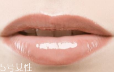 嘴唇干裂是一種病嗎？治療口角炎從改善習(xí)慣入手