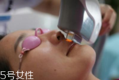 科技脫毛有哪些種類？冰點脫毛不毀毛囊