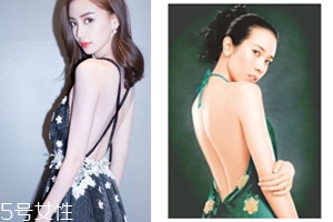 怎樣矯正背溝缺失？減肥運(yùn)動(dòng)是關(guān)鍵