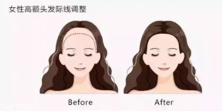 發(fā)際線粉填充和發(fā)際線筆哪個(gè)好？配合使用才最完美