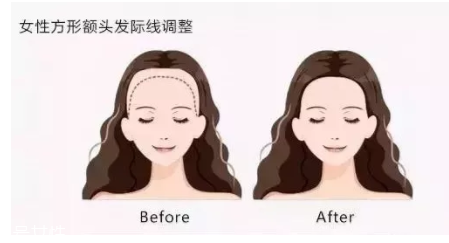 發(fā)際線粉填充和發(fā)際線筆哪個(gè)好？配合使用才最完美