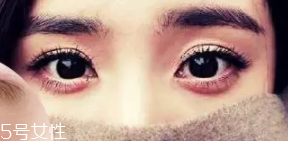 臥蠶和眼袋的區(qū)別是什么？臥蠶是肌肉眼袋是肥肉