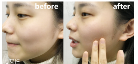 蘭蔻粉水適合什么年齡？只針對(duì)年輕肌底