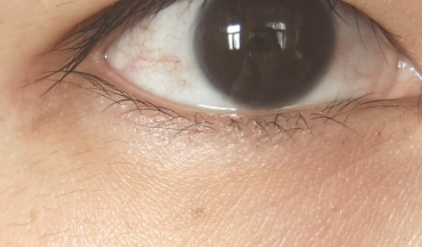 雅詩(shī)蘭黛適合敏感肌嗎？