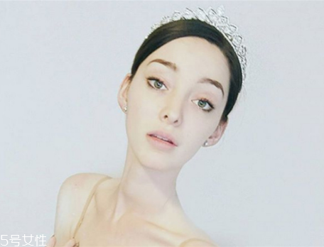 法令紋填充需要幾只玻尿酸？千萬(wàn)不可過量