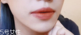 怎么變成櫻桃小嘴？大嘴唇變小攻略