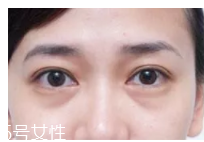 黑眼圈用什么眼霜好？多效護理型眼霜是首選