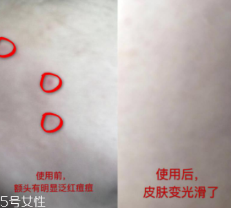 資生堂紅腰子適合什么年齡？最適合30歲以下人群