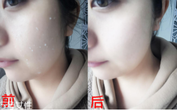 rosette去角質(zhì)凝膠怎么樣？真正的去角質(zhì)產(chǎn)品