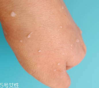 rosette去角質(zhì)凝膠怎么樣？真正的去角質(zhì)產(chǎn)品