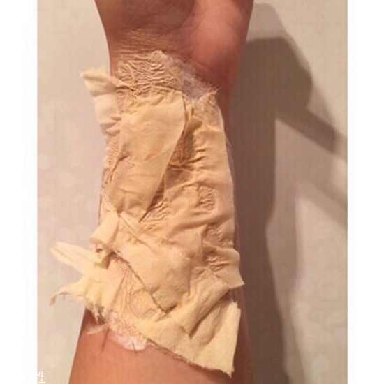 怎么在手上畫(huà)流血傷口 受傷妝具體步驟 怎么在手上畫(huà)流血傷口 受傷妝具體步驟