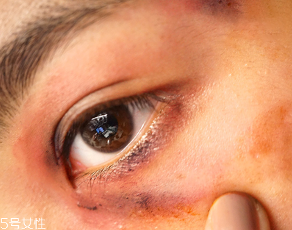 怎么在手上畫(huà)流血傷口 受傷妝具體步驟 怎么在手上畫(huà)流血傷口 受傷妝具體步驟