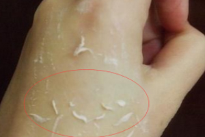 去角質(zhì)凝露多久用一次？皮厚一周一次