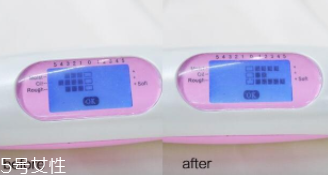 sk2神仙水適合油皮嗎？油皮親媽