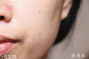 悅木之源和伊麗莎白雅頓哪個好？兩款精華大比拼