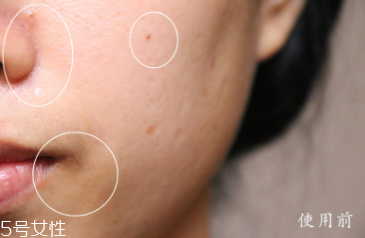 悅木之源和伊麗莎白雅頓哪個好？兩款精華大比拼