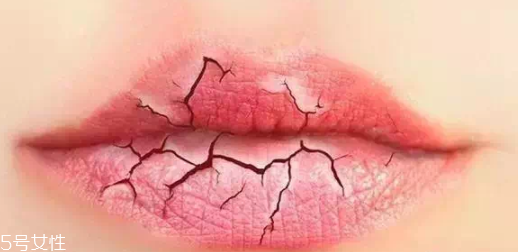 唇紋深適合什么口紅？別用啞光口紅