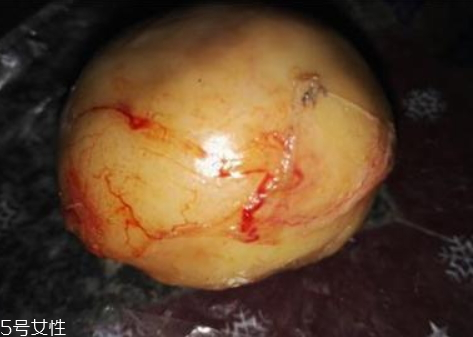 鴨寶多少錢一克 鑒定方法 鴨寶多少錢一克 鑒定方法