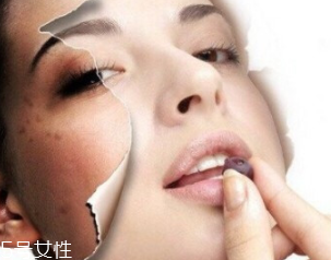 春季如何預(yù)防皮膚過(guò)敏？選擇敏感肌專(zhuān)用護(hù)膚品