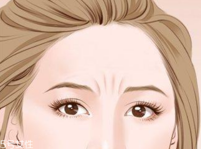 川字紋可以手術(shù)去除嗎？選擇手術(shù)需謹(jǐn)慎