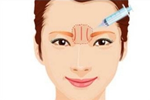 川字紋可以手術(shù)去除嗎？選擇手術(shù)需謹(jǐn)慎