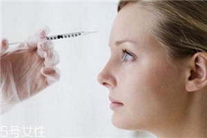 川字紋可以打玻尿酸嗎？不是最佳選擇