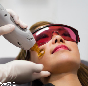 唇毛怎么去掉小竅門 4種常見(jiàn)去毛方法的優(yōu)缺點(diǎn)