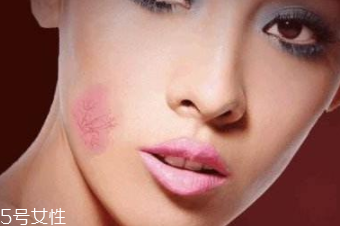 紅血絲用哪種護(hù)膚品？6款大牌全面對抗紅血絲