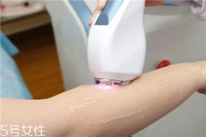 脫毛儀可以脫發(fā)際線嗎？脫了還會(huì)再長(zhǎng)