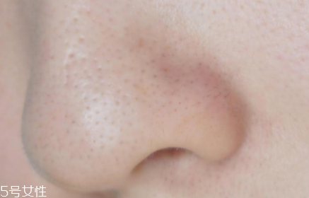 薇姿魔幻水怎么樣？薇姿水光煥亮角質(zhì)調(diào)理液好用嗎？