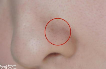 薇姿魔幻水怎么樣？薇姿水光煥亮角質(zhì)調(diào)理液好用嗎？