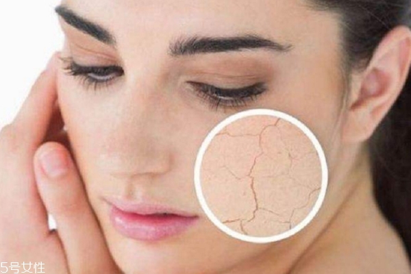 護(hù)膚水用了臉上刺痛怎么回事？這3點(diǎn)是關(guān)鍵