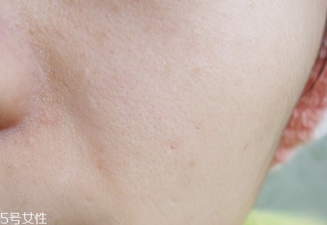 ipsa清潔面膜去黑頭怎么樣 臉上有黑頭怎么去除好 ipsa清潔面膜去黑頭怎么樣 臉上有黑頭怎么去除好