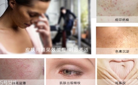 德國krauterhof蝸牛精華膏效果怎么樣？