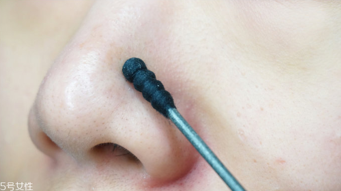 怎樣安全去除黑頭 安全去除黑頭的方法 怎樣安全去除黑頭 安全去除黑頭的方法