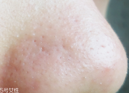 ipsa清潔面膜去黑頭怎么樣 臉上有黑頭怎么去除好 ipsa清潔面膜去黑頭怎么樣 臉上有黑頭怎么去除好