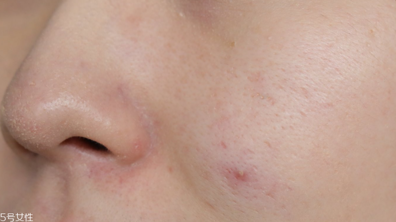 蘭蔻氣墊素顏霜怎么樣？遮瑕度不夠