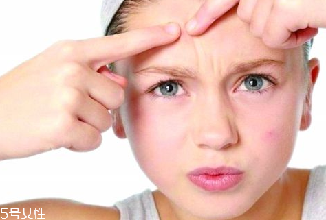 skinb5抗痘護膚片有效果嗎？