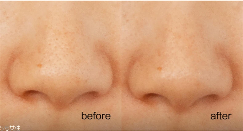 悅詩風(fēng)吟慕斯清潔面膜溫和嗎？干皮慎用