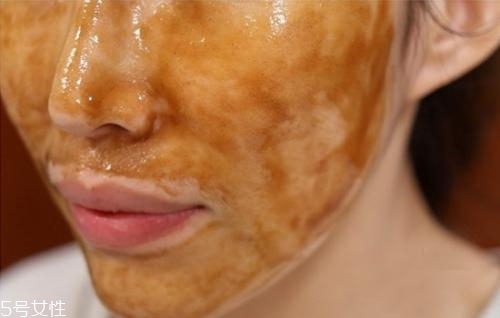 夏天油皮不能敷哪種面膜？這三種面膜越敷越油