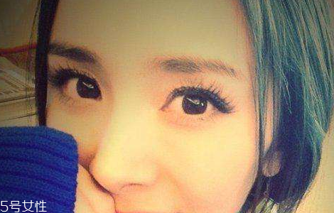 葉黃素能治白內障嗎？有一定改善作用