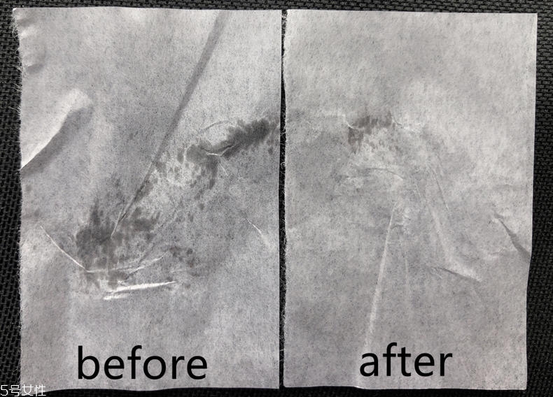 清揚植覺洗發(fā)水怎么樣 給頭皮也用爽膚水 清揚植覺洗發(fā)水怎么樣 給頭皮也用爽膚水