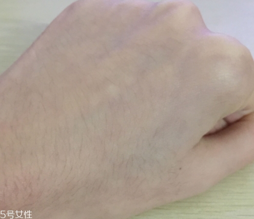 創(chuàng)爾美和可復(fù)美哪個好？