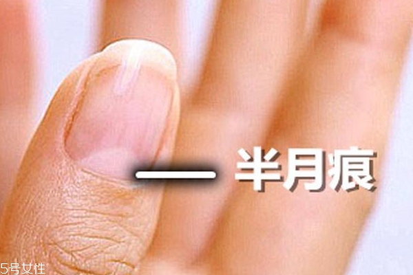 指甲的月牙說明什么？看完我趕緊放下甲油