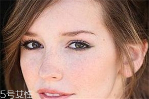 臉上長(zhǎng)斑怎么辦 防止臉上長(zhǎng)斑的方法 臉上長(zhǎng)斑怎么辦 防止臉上長(zhǎng)斑的方法