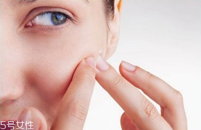 悶痘如何讓其排出來 先要找好悶痘原因 悶痘如何讓其排出來 先要找好悶痘原因