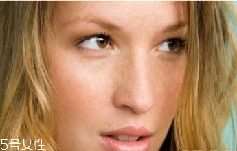 臉上長(zhǎng)斑怎么辦 防止臉上長(zhǎng)斑的方法 臉上長(zhǎng)斑怎么辦 防止臉上長(zhǎng)斑的方法