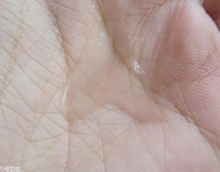 sisley花香化妝水過(guò)敏原因 防腐劑嚴(yán)重超標(biāo)